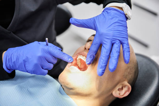 Best Chipped Tooth Repair Near Me  in Spring Grove, PA